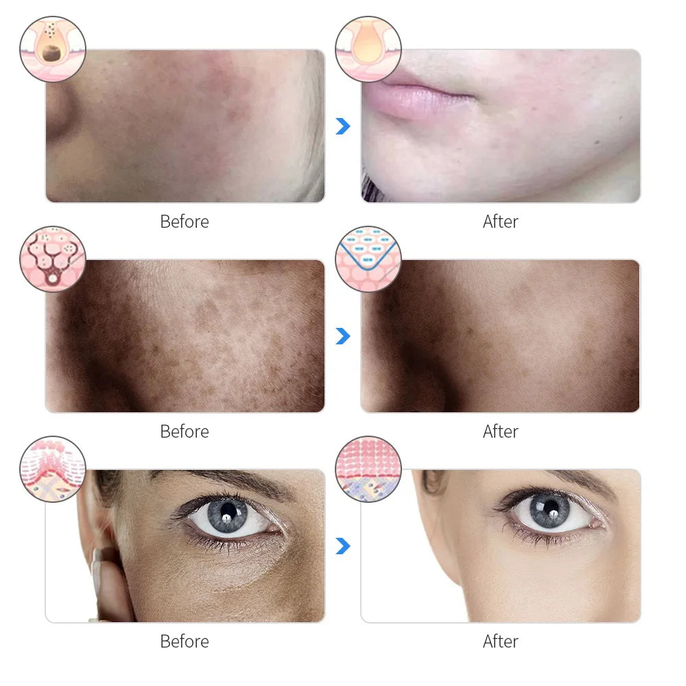 GlowWave LED Therapy Mask